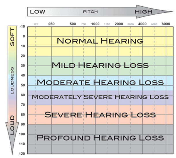 hearing-aid-level-chart